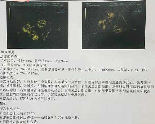 云南医院试管婴儿比较好的大家知道吗?,云南热门试管医院导航